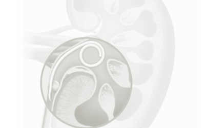 Stent Ureterali: Evoluzione o Rivoluzione